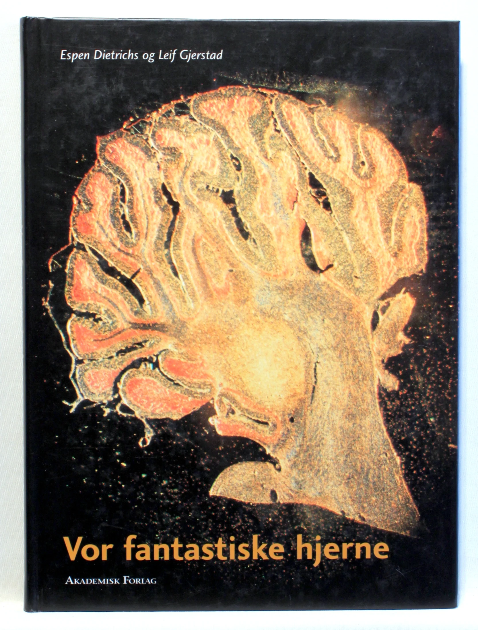 Vor fantastiske hjerne