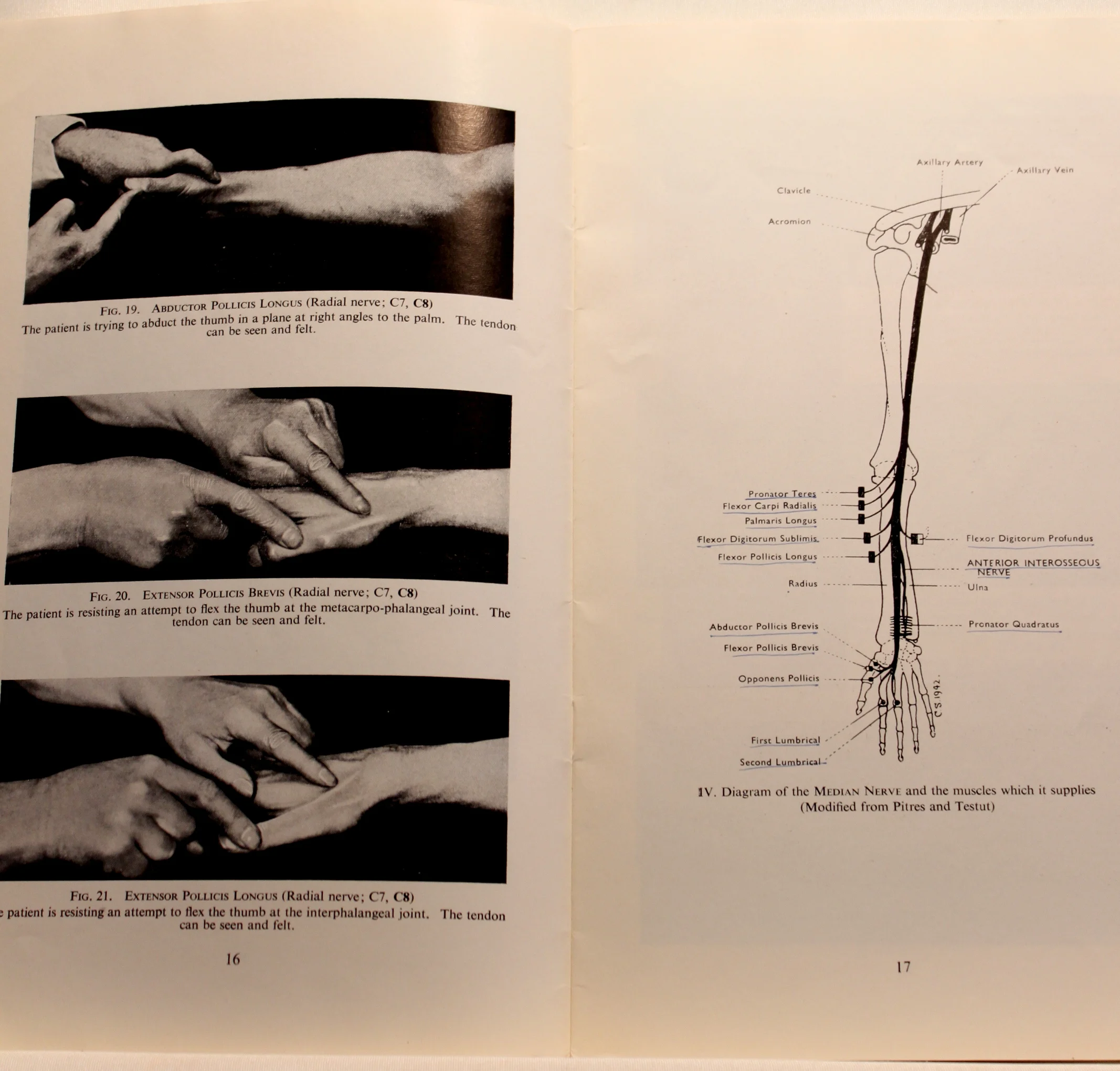 Medical Research Council War Memorandum No. 7. Aids To The Investigation Of Peripheral Nerve Injuries
